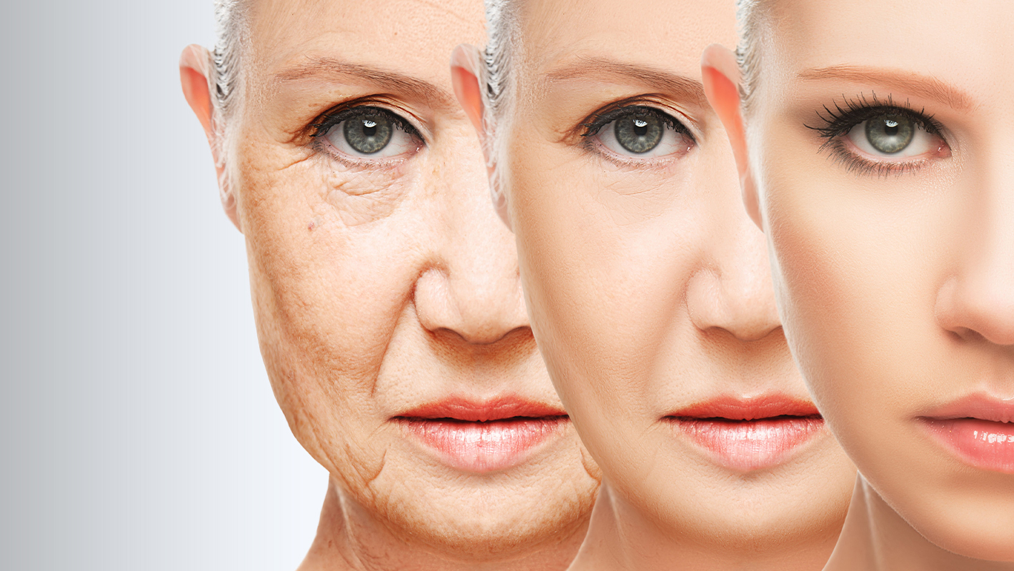 Facial Volume Loss Treatments | MMC Medical Aesthetics